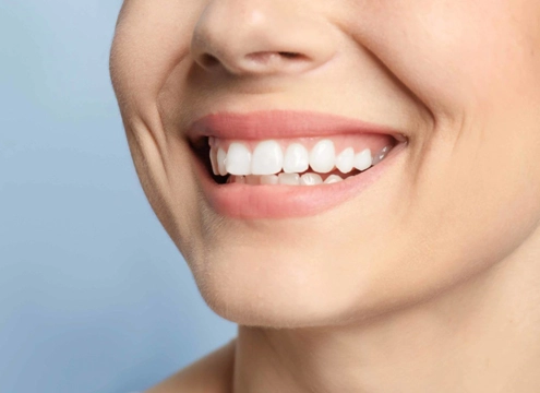 Gummy Smile Tedavisi