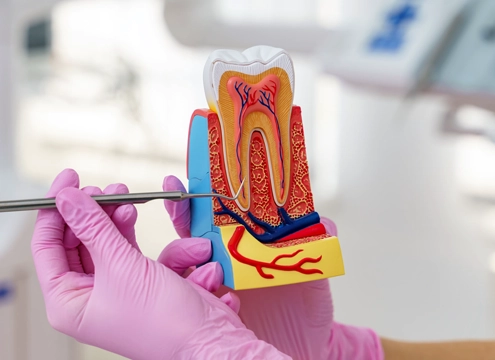 Kanal Tedavisi Yenileme